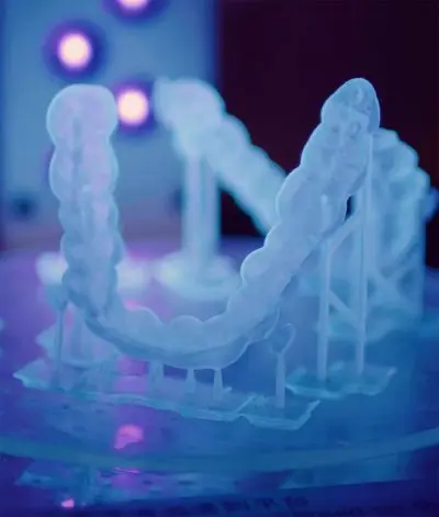 Grafik zur schrittweisen Zahnbewegung mit Invisalign-Schienen.